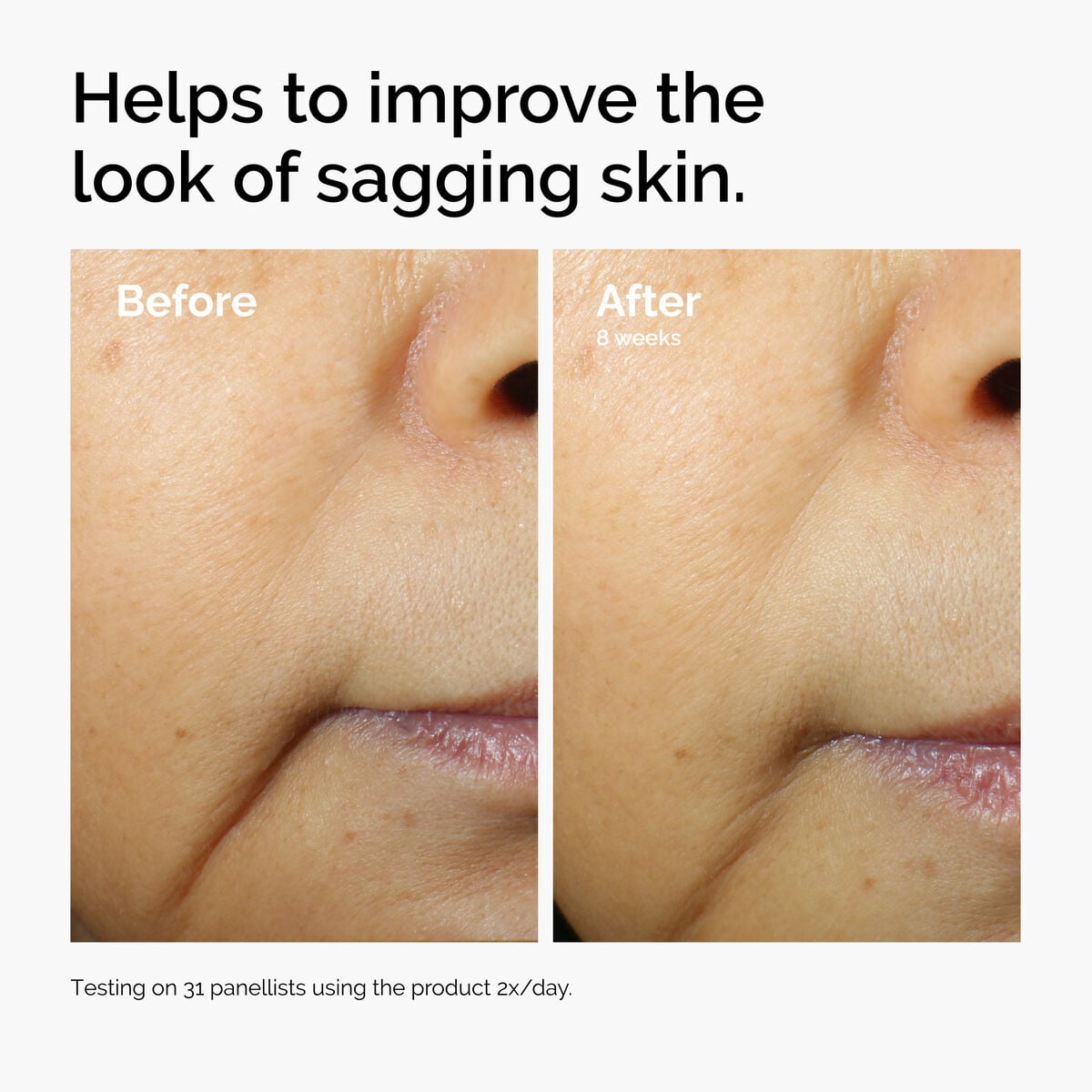 caffeine-3-escin-1-face-serum-e6 ord-caffeine-3pct-escin-1pct-face-serum-before-after-sagging.jpg