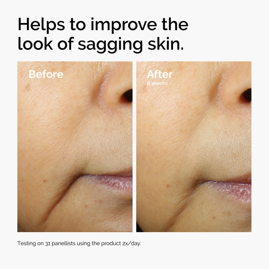 caffeine-3-escin-1-face-serum-e6 ord-caffeine-3pct-escin-1pct-face-serum-before-after-sagging.jpg