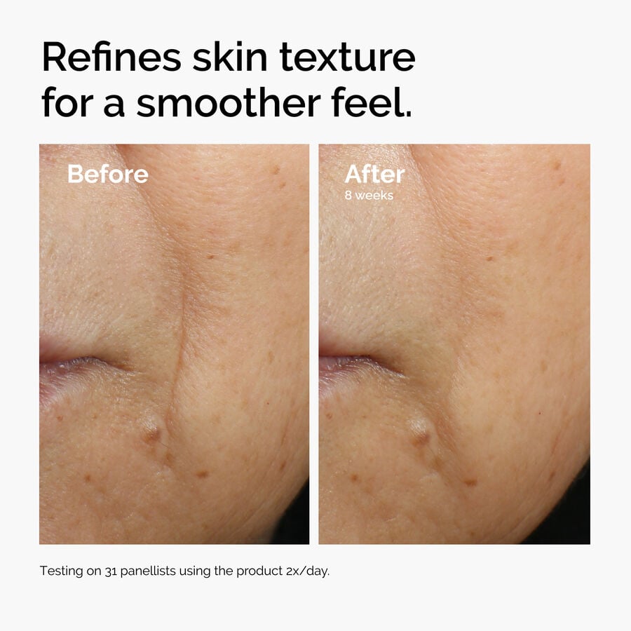 caffeine-3-escin-1-face-serum-e6 ord-caffeine-3pct-escin-1pct-face-serum-before-after-texture.jpg