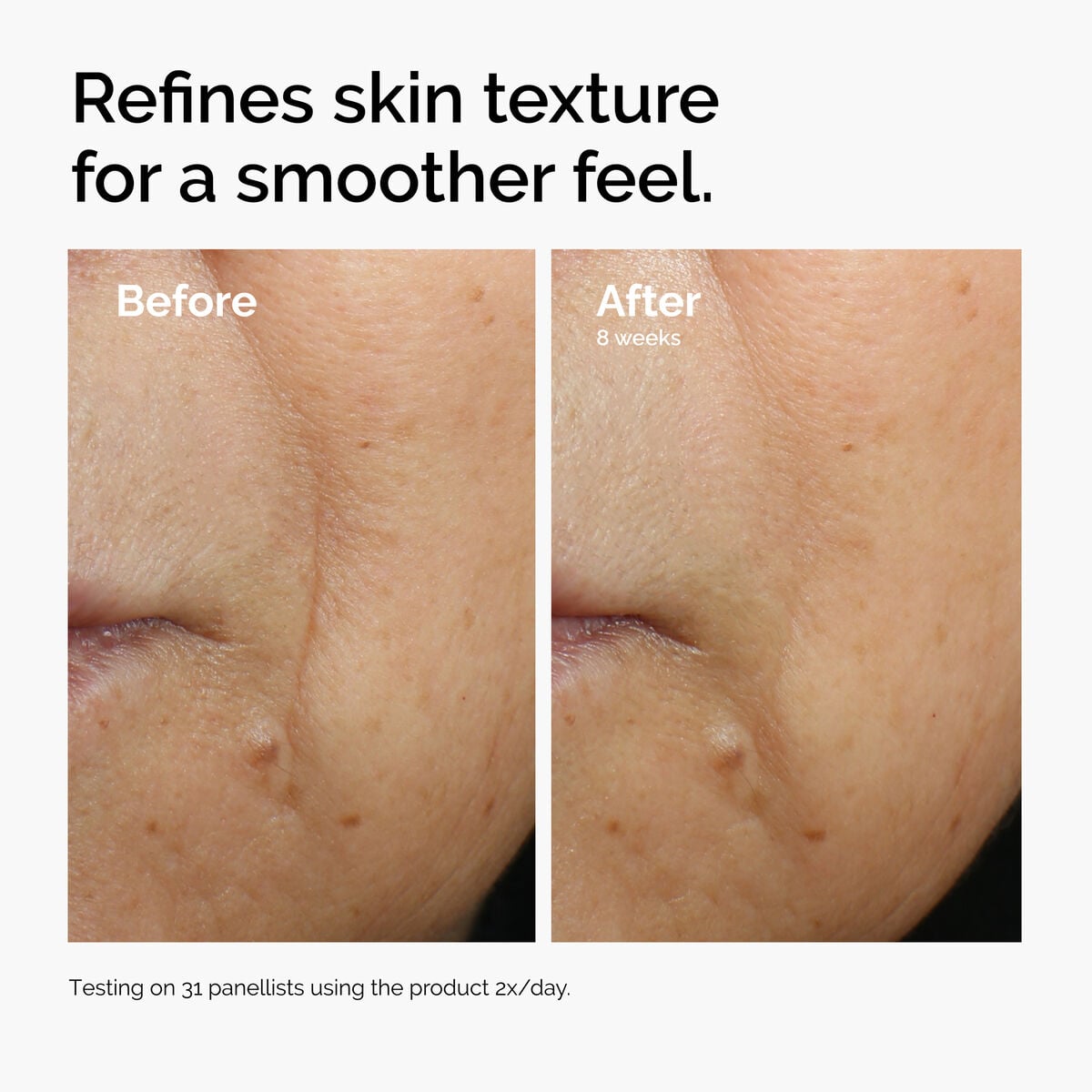 caffeine-3-escin-1-face-serum-e6 ord-caffeine-3pct-escin-1pct-face-serum-before-after-texture.jpg