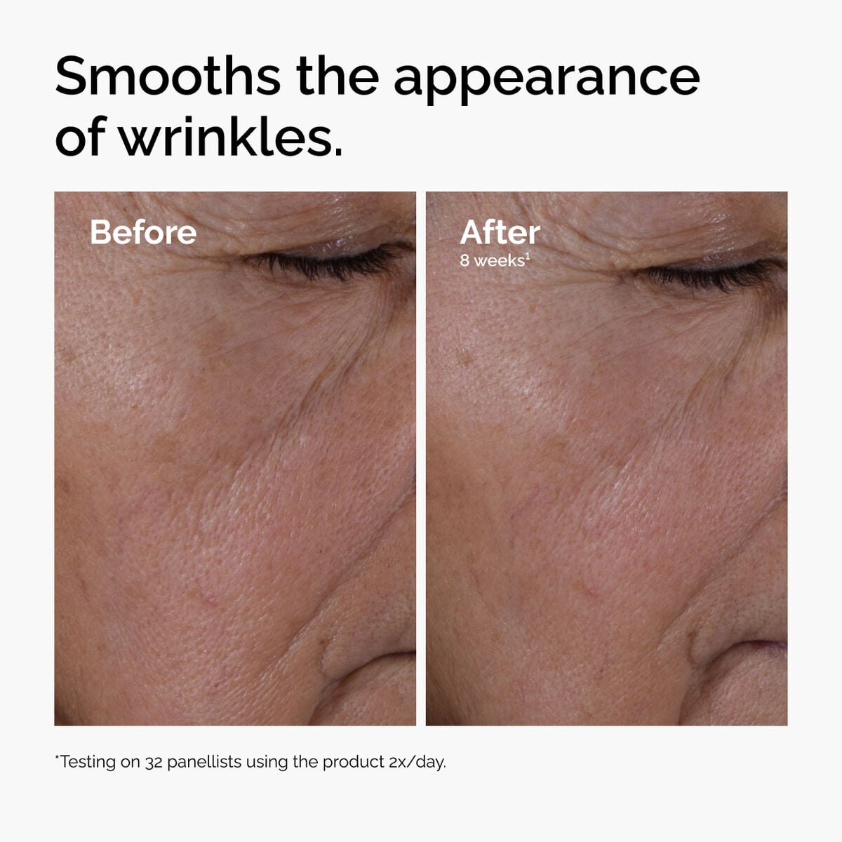 multi-peptide-ha-serum-q9 ord-multi-peptide-ha-serum-wrinkles-before-after.jpg