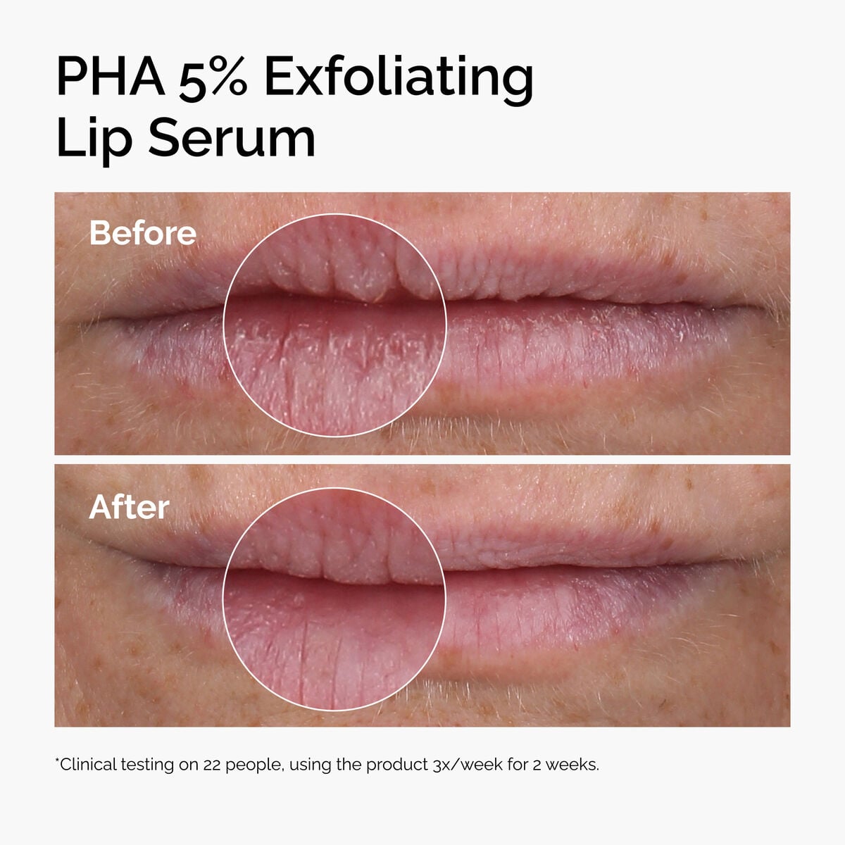 pha-5-exfoliating-lip-serum-f1 ord-pha-5pct-lip-exfoliating-serum-before-after.jpg