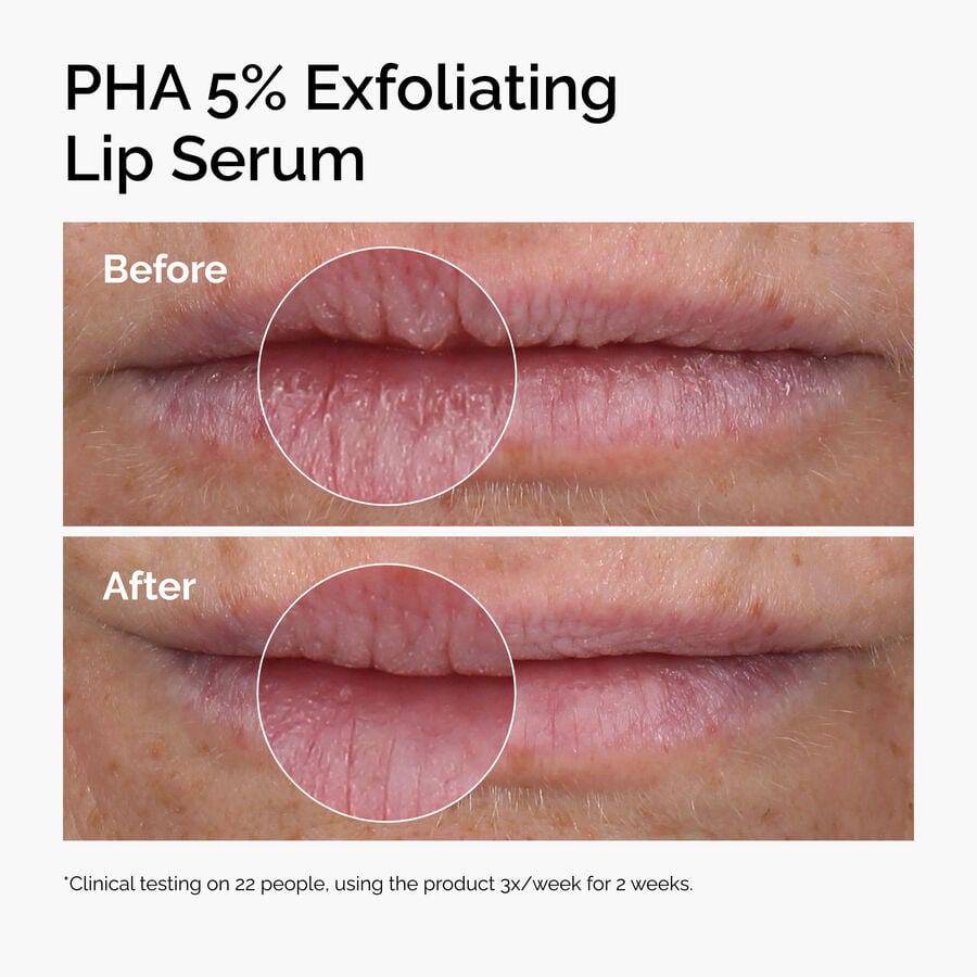 pha-5-exfoliating-lip-serum-f1 ord-pha-5pct-lip-exfoliating-serum-before-after.jpg