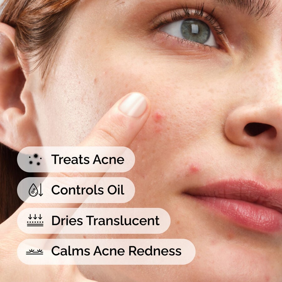 sulfur-10-powder-to-cream-concentrate-q7 ord-sulfur-10pct-powder-to-cream-concentrate-model-application-with-benefits-acne.jpg